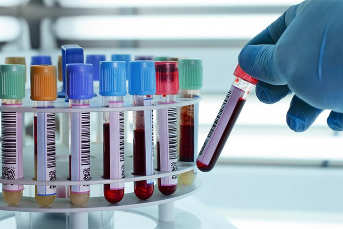 Lấy máu xét nghiệm tại nhà - Giải pháp sức khỏe thời hiện đại